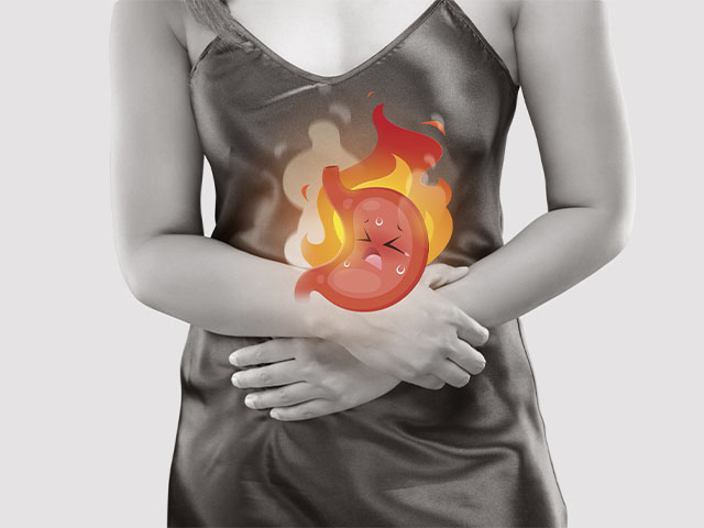 Embarazo y ardor de estómago